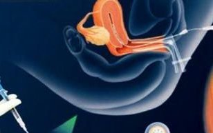 子宫纵隔生育困难可以在永安市做三代试管吗？子宫有问题做试管的成功率高吗？